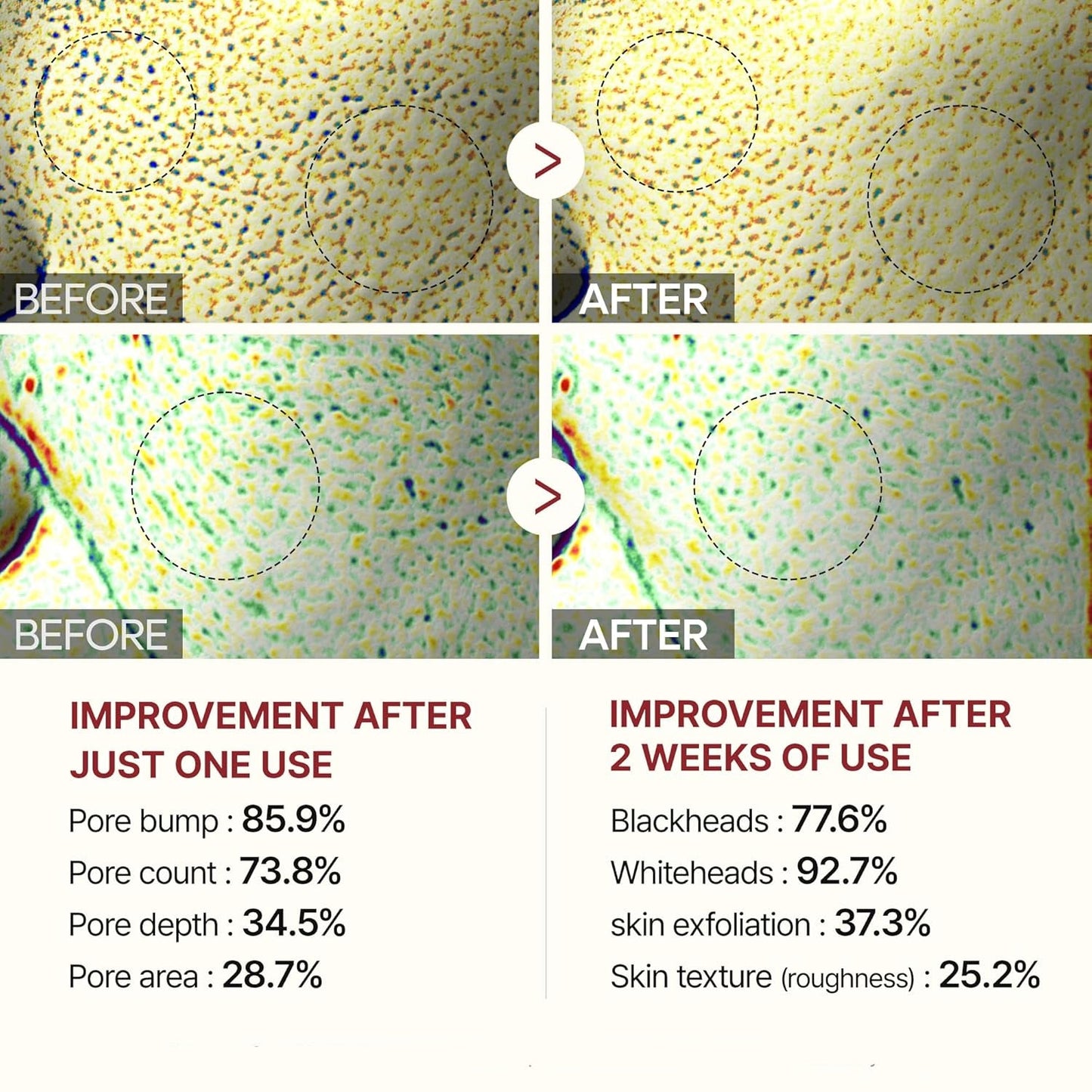 AuroraRice™ Dual Radiance Peel