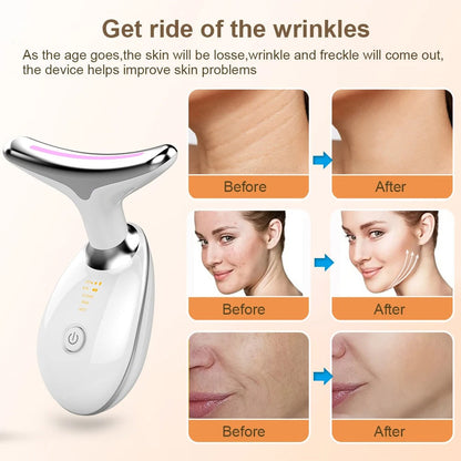Nuvéa™ - Neck & Face Lifting Massager
