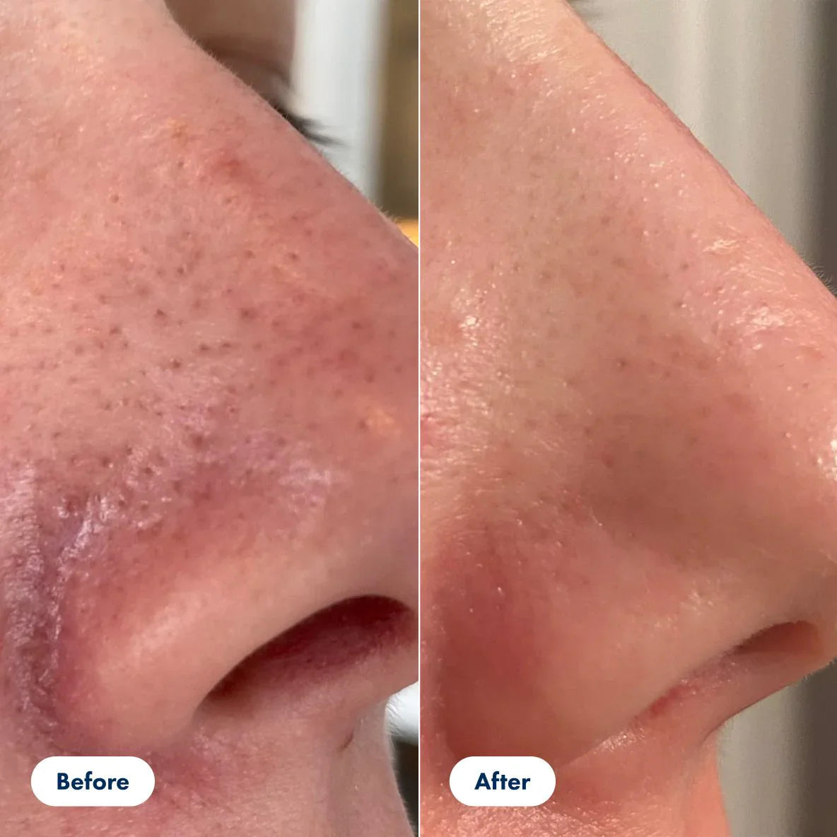 AuroraRice™ Dual Radiance Peel