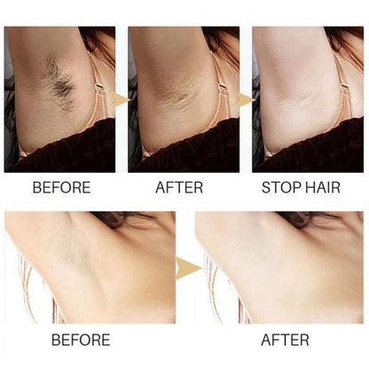 SmoothSerum™ – Hair Removal Serum