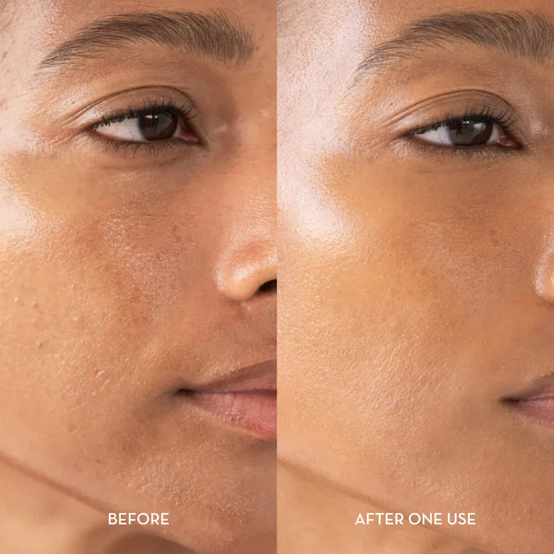 AuroraRice™ Dual Radiance Peel