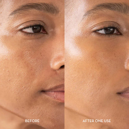 AuroraRice™ Dual Radiance Peel